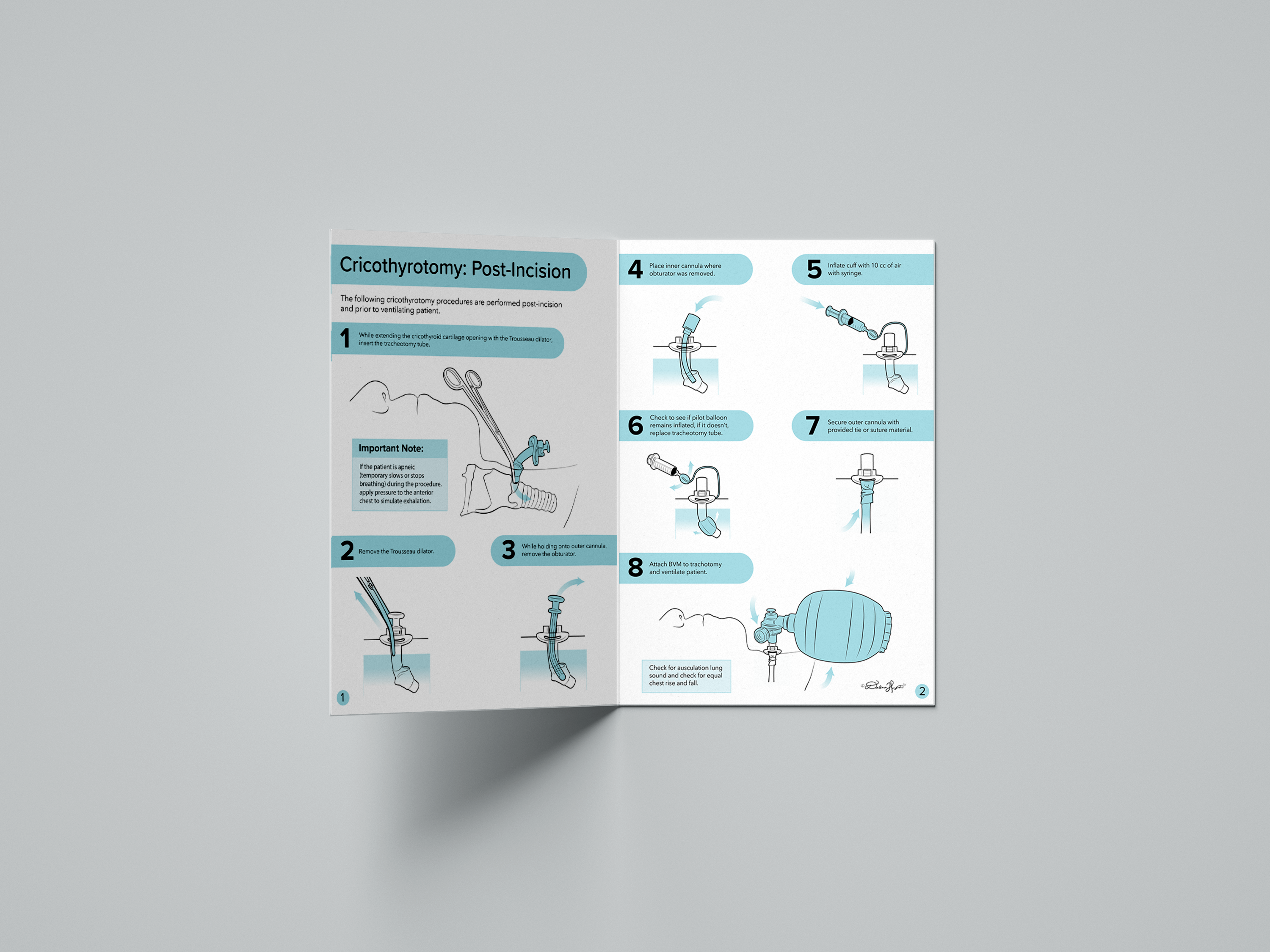 A mockup of a two page pamphlet on cricothyrotomy